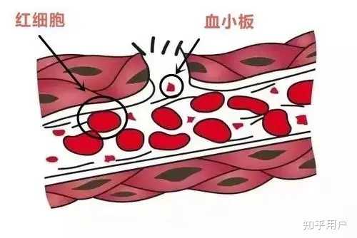 为什么我的皮肤容易受伤淤青？ - 知乎
