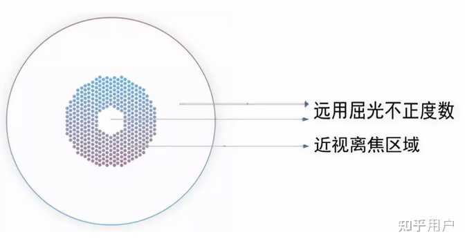 离焦眼镜怎么选? - 知乎