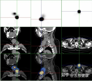 v2-b462d25a1ebf84b0df00b4e5450a0bdb